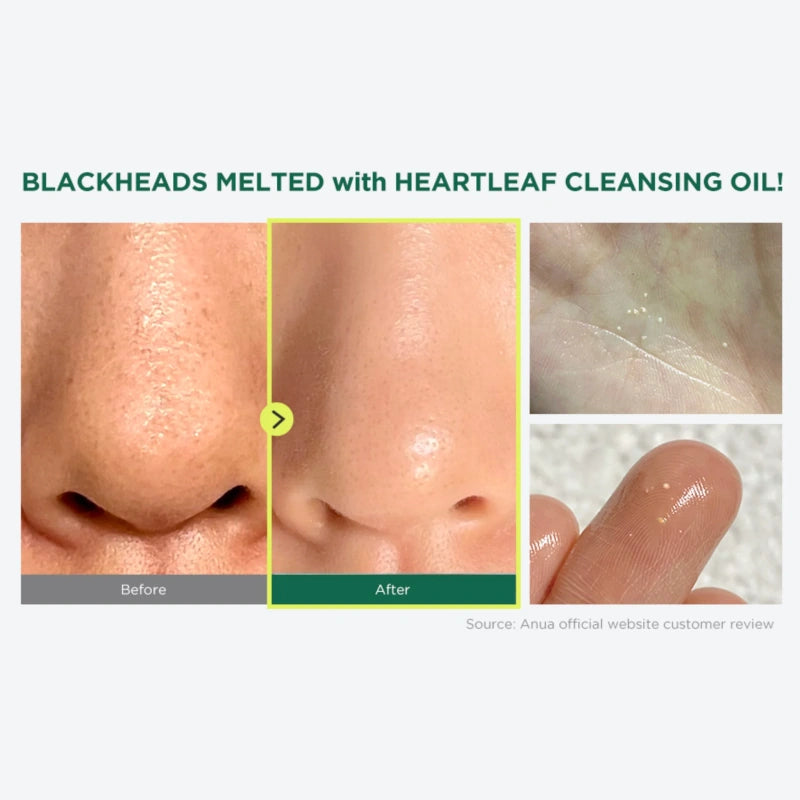 ANUA Heartleaf Pore Control Cleansing Oil – Λάδι Καθαρισμού Προσώπου & Πόρων 200ml